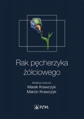 Rak pęcherzyka żółciowego