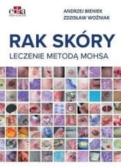 Rak skóry. Leczenie metodą Mohsa -  Bieniek Andrzej,  Woźniak Zdzisław