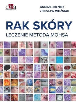Rak skóry. Leczenie metodą Mohsa -  Bieniek Andrzej,  Woźniak Zdzisław