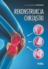 Rekonstrukcja chrząstki - Bartłomiej Kacprzak