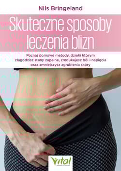Skuteczne sposoby leczenia blizn - Bringeland Nils E.