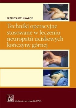Techniki operacyjne stosowane w leczeniu.. - Nawrot Przemysław