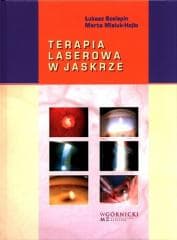 Terapia laserowa w jaskrze - Szelepin Łukasz,  Misiuk-Hojło Marta