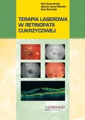 Terapia laserowa w retinopatii cukrzycowej - Praca zbiorowa