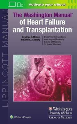 The Washington Manual of Heart Failure and Transplantation - Jonathan Moreno