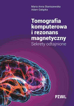 Tomografia komputerowa i rezonans magnetyczny - Staniszewska Maria Anna, Gałązka Adam