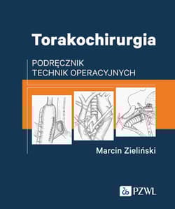Torakochirurgia. Podręcznik technik operacyjnych - Marcin Zieliński