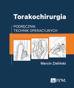 Torakochirurgia. Podręcznik technik operacyjnych - Marcin Zieliński