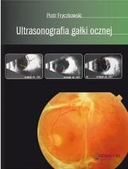 Ultrasonografia gałki ocznej -  Fryczkowski Piotr