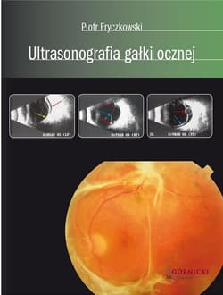 Ultrasonografia gałki ocznej -  Fryczkowski Piotr