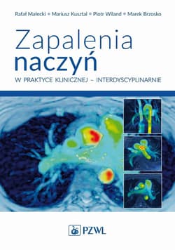 Zapalenia naczyń w praktyce klinicznej... - Praca zbiorowa