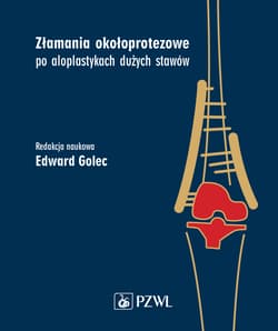 Złamania okołoprotezowe po aloplastykach dużych... - Edward Golec