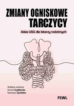 Zmiany ogniskowe tarczycy - Szydlarska Dorota, Katarzyna Życińska