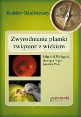 Zwyrodnienie plamki związane z wiekiem - red. Edward Wylęgała
