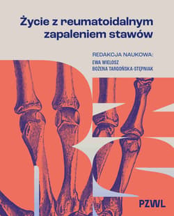 Życie z reumatoidalnym zapaleniem stawów - Wielosz Ewa, Bożena Targońska-Stępniak