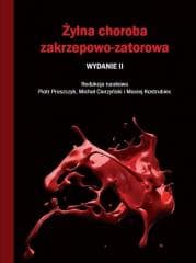 Żylna choroba zakrzepowo-zatorowa -  Ciurzyński Michał, Kostrubiec Ma